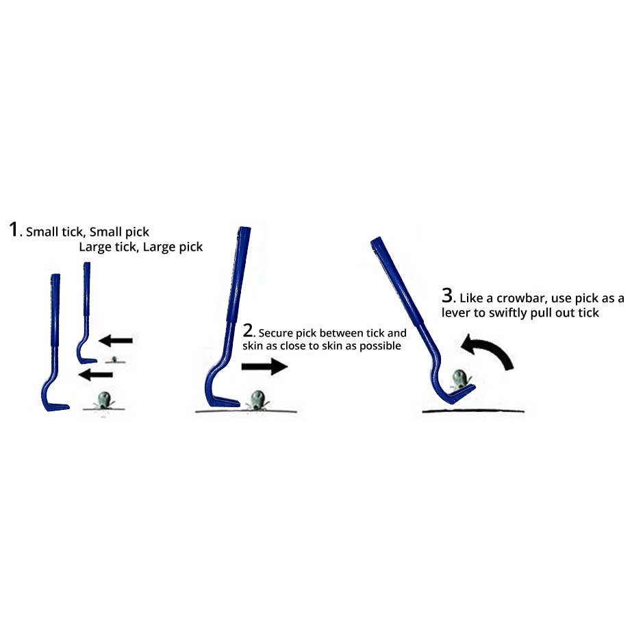 Atlantick TickPick® — Tick Removal Tool